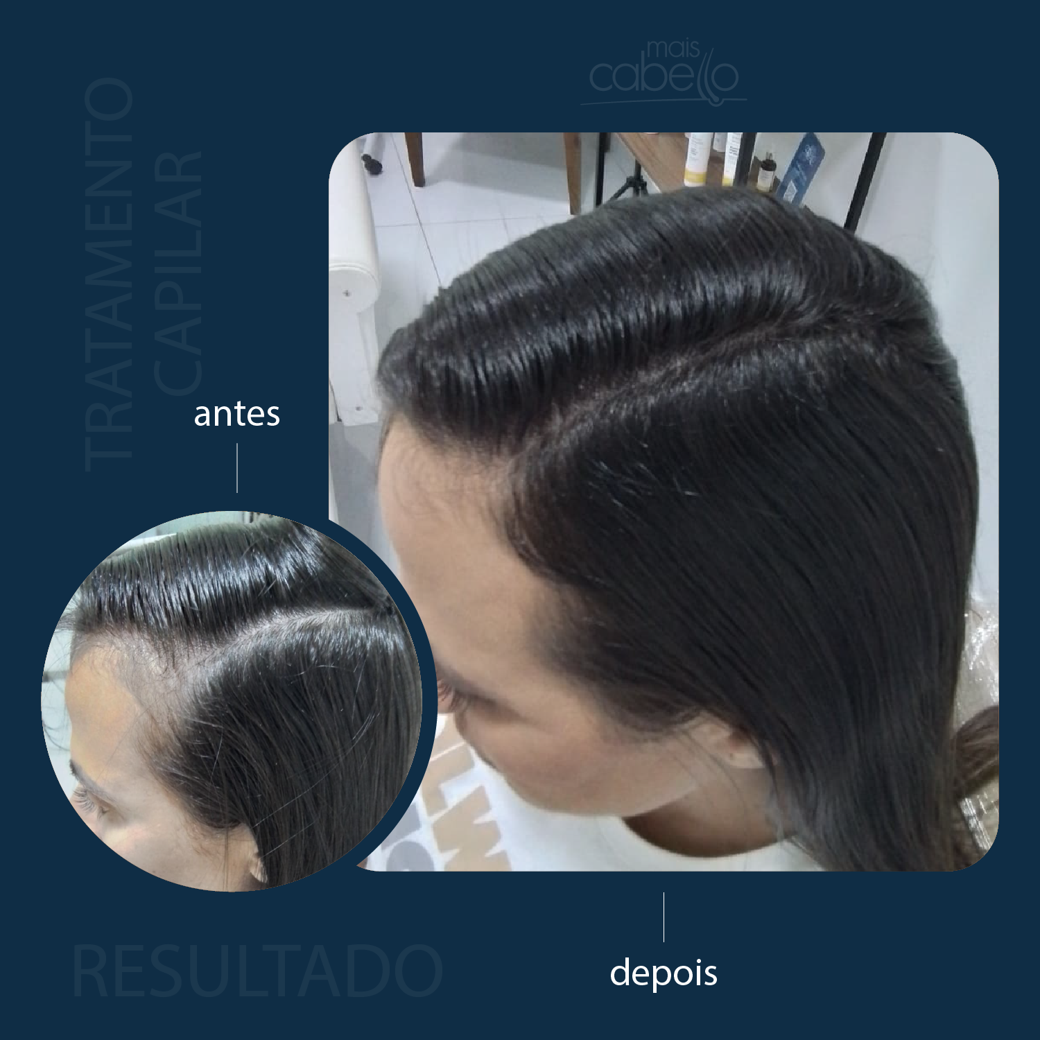 Antes e Depois - Ganho de Cobertura